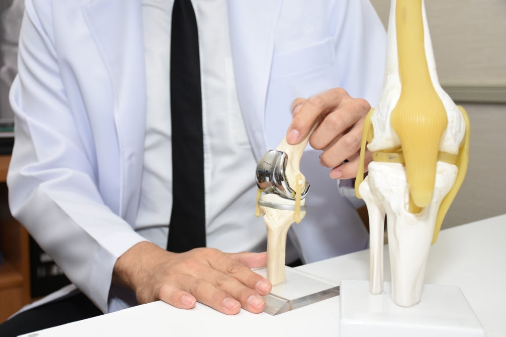 A doctor shows off a model of a knee replacement.